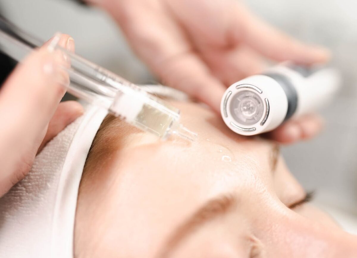microneedling-with-ems-mesotherapy-2