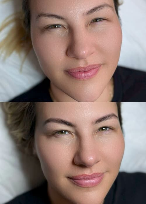 before-after-brows8