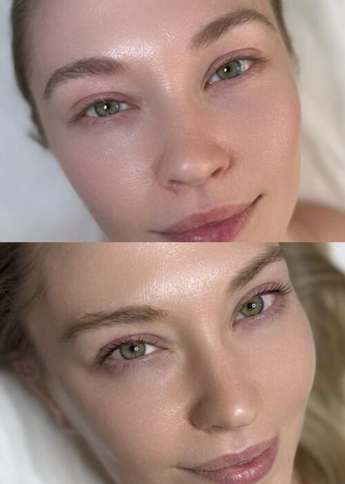 before-after-lashes2
