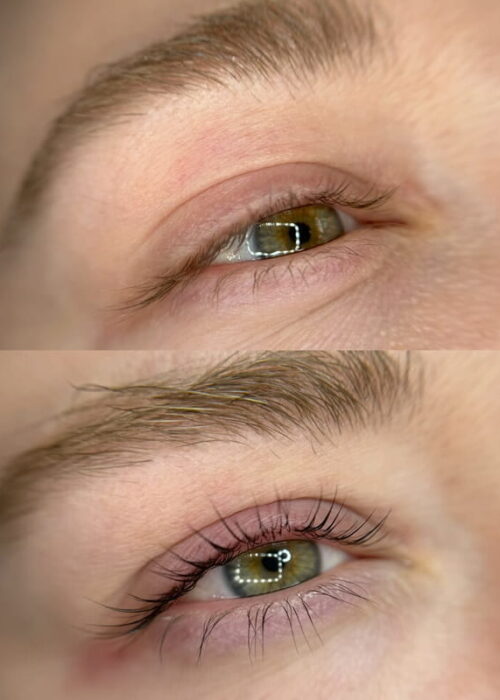 before-after-lashes3